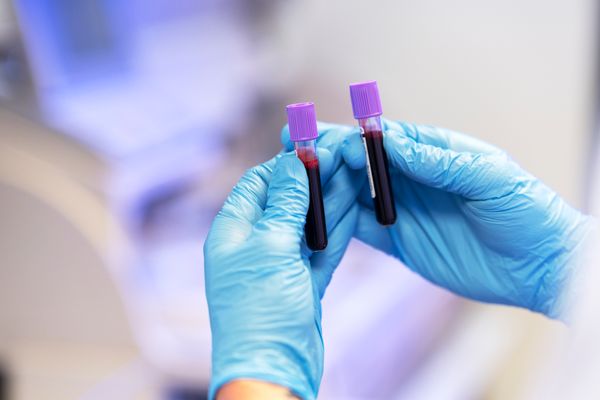 Test genético en el embarazo: ¿Qué es y cómo se realiza?