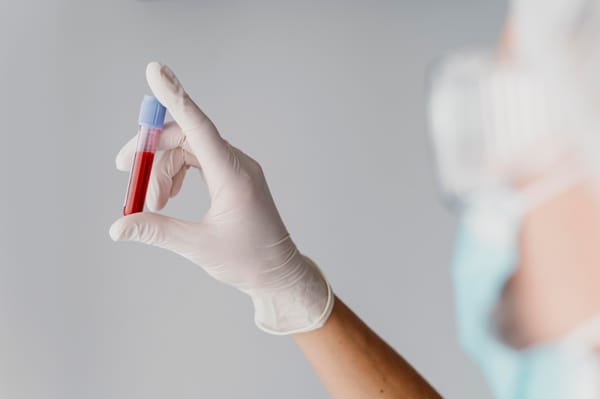 ¿Para qué sirve el examen de testosterona? La importancia de esta hormona nuestra salud